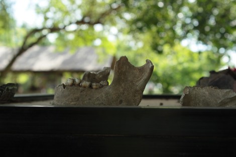 Machoire-Killing-Fields-Phnom-Penh